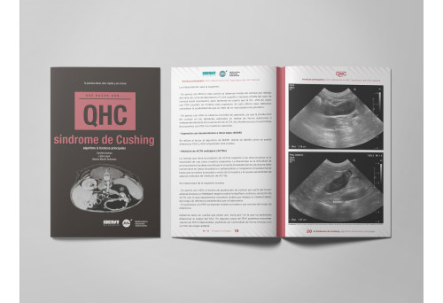 Revista QHC Síndrome de Cushing -Que Hacer Con... veterinaria