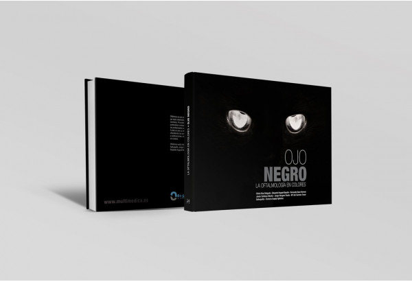 Ojo negro. La oftalmologí­a en colores -Manuales prácticos veterinaria
