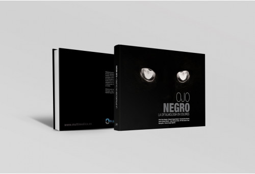 Ojo negro. La oftalmologí­a en colores -Manuales prácticos veterinaria